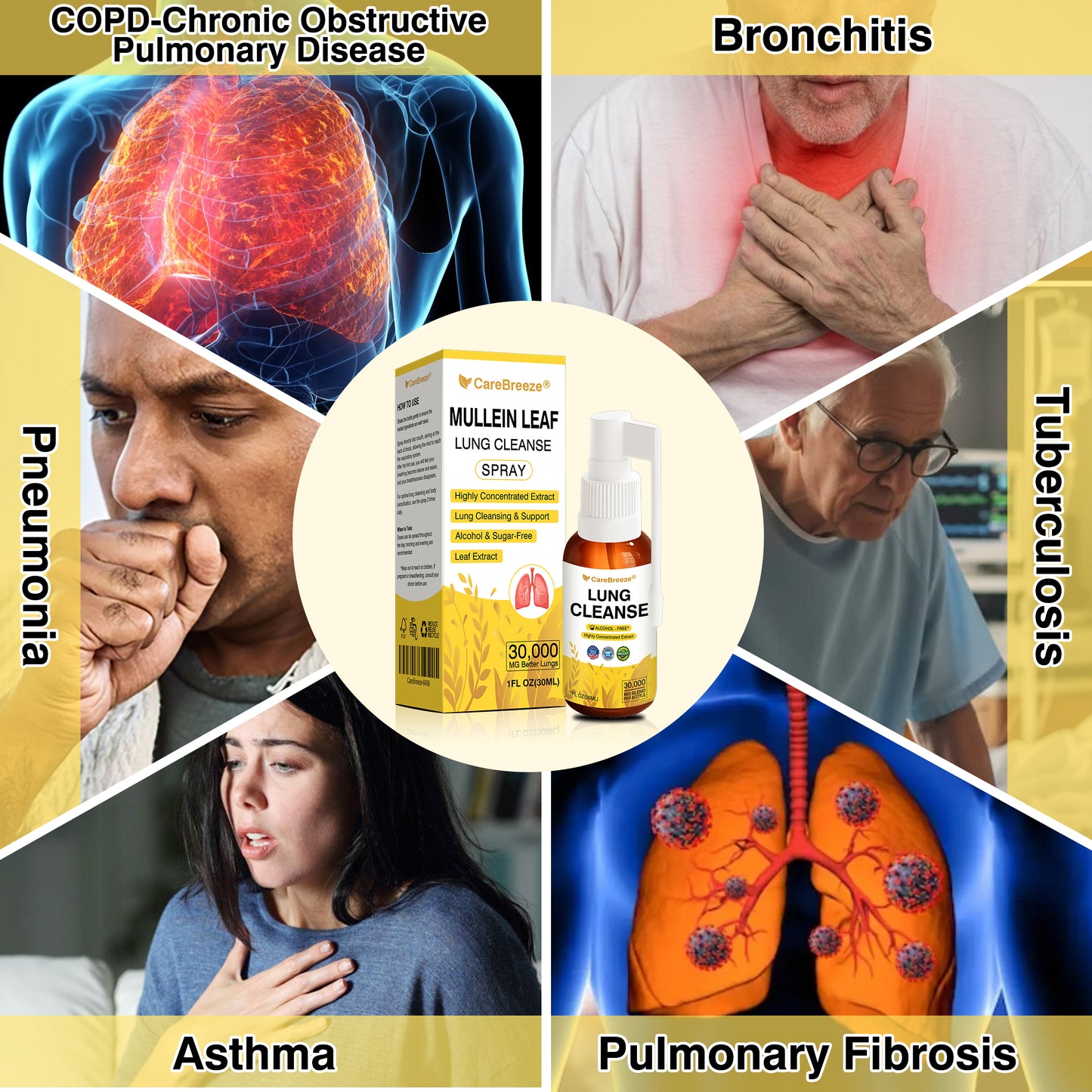 🫁🇬🇧 Official Store:CareBreeze® Botanical Mullein Leaf Extract Lung Cleanse Spray（💛Directly acts on COPD, asthma, chronic bronchitis (CB), respiratory infections, lung cancer, sinusitis, and other conditions💛）
