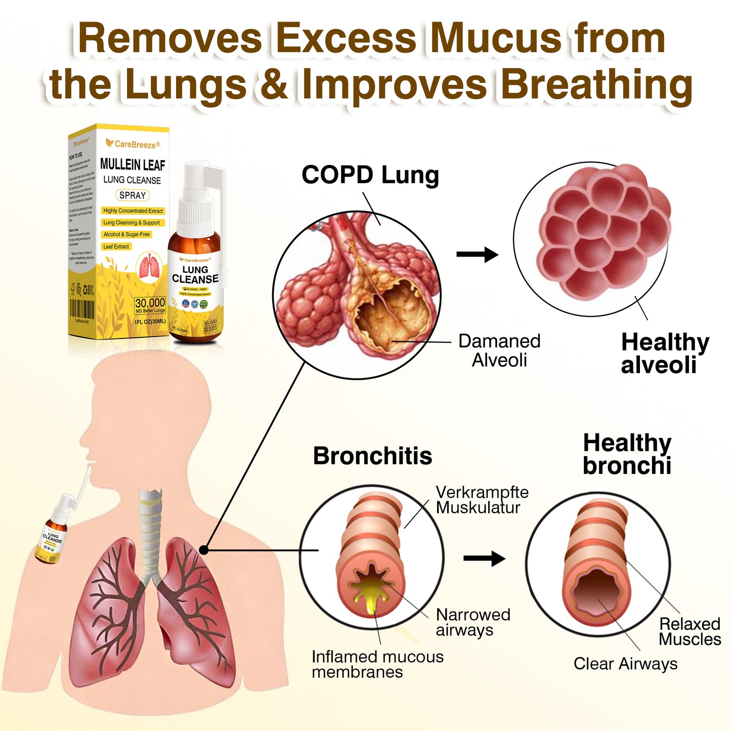 🫁🇬🇧 Official Store:CareBreeze® Botanical Mullein Leaf Extract Lung Cleanse Spray（💛Directly acts on COPD, asthma, chronic bronchitis (CB), respiratory infections, lung cancer, sinusitis, and other conditions💛）