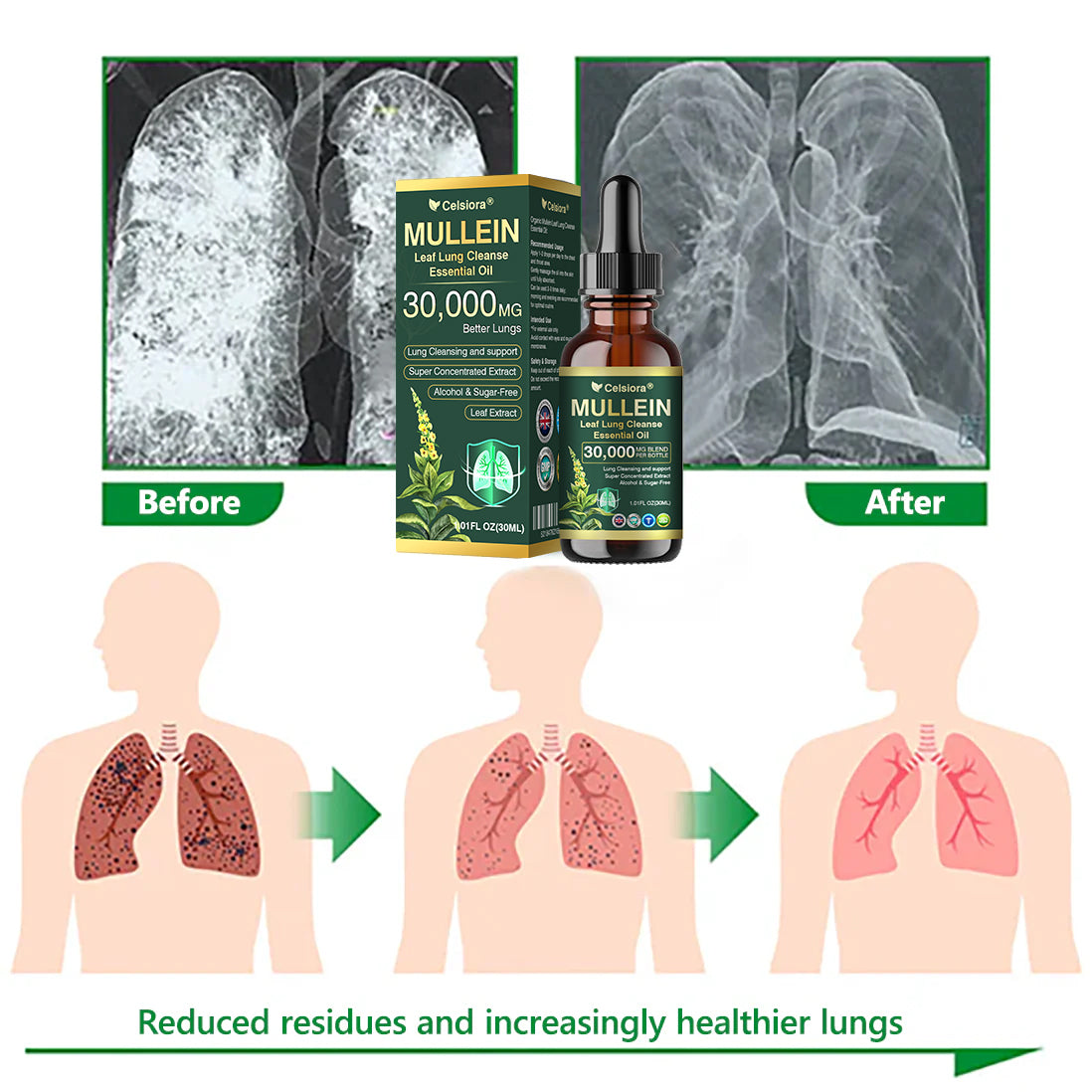 ✅𝐔𝐊 𝐎𝐟𝐟𝐢𝐜𝐢𝐚𝐥 𝐒𝐭𝐨𝐫𝐞|𝐂𝐞𝐥𝐬𝐢𝐨𝐫𝐚® 𝐎𝐫𝐠𝐚𝐧𝐢𝐜 𝐌𝐮𝐥𝐥𝐞𝐢𝐧 𝐋𝐞𝐚𝐟 𝐋𝐮𝐧𝐠 𝐂𝐥𝐞𝐚𝐧𝐬𝐞 𝐄𝐬𝐬𝐞𝐧𝐭𝐢𝐚𝐥 𝐎𝐢𝐥 (🫁Cough, wheezing, shortness of breath, sputum, stuffy nose, bronchitis, bronchitis, allergy symptoms, lung discomfort💝)