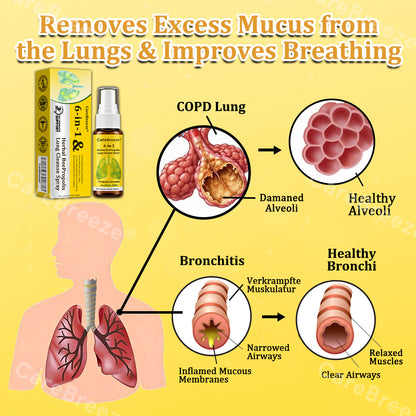 🐝🇬🇧 Official Store:CareBreeze® 6-in-1 Herbal BeePropolis Lung Cleanse Spray（👨‍⚕️Directly acts on COPD, asthma, chronic bronchitis (CB), respiratory infections, lung cancer, sinusitis, and other conditions🫁）
