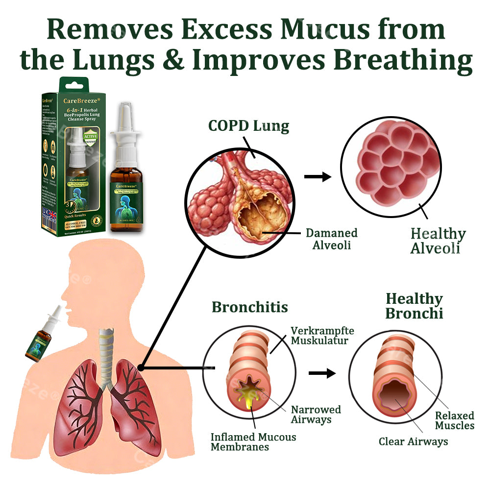 💚🇬🇧 Official Store:CareBreeze® 6-in-1 Herbal BeePropolis Lung Cleanse Spray🐝（👨‍⚕️Directly acts on COPD, asthma, chronic bronchitis (CB), respiratory infections, lung cancer, sinusitis, and other conditions）