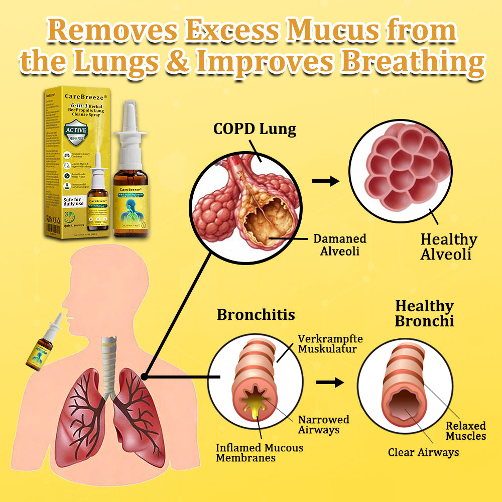 🇬🇧 🐝✅UK Official Store:CareBreeze® 6-in-1 Herbal BeePropolis Lung Cleanse Spray（👨‍⚕️Directly acts on COPD, asthma, chronic bronchitis (CB), respiratory infections, lung cancer, sinusitis, and other conditions）