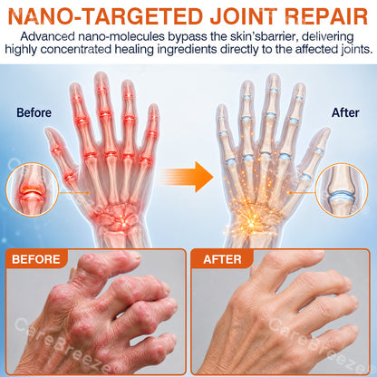 💝✅🇬🇧  CareBreeze® Pain-Relief Bone-Healing Microneedle Patch(🧑‍⚕️Reducing joint swelling, pain, stiffness, redness, warmth, soreness, and joint fatigue)