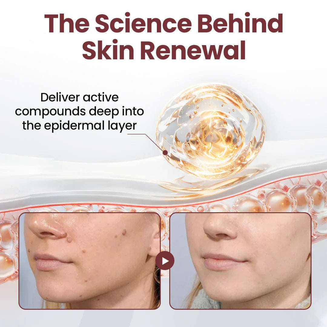 👑✅Pheromex®Dual-Action Plant Wart Removal Cream（👨‍⚕️Skin Tags,Acne,Hyperpigmentation,Eczema,Psoriasis,Rosacea,Warts)