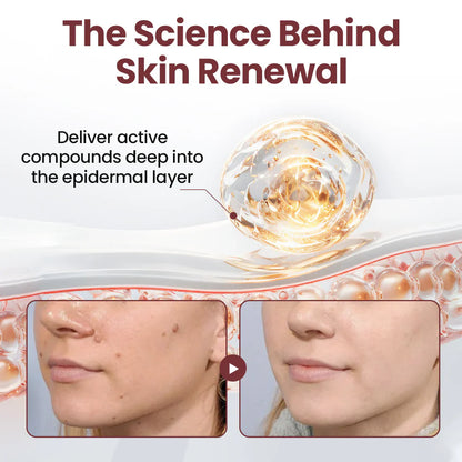 👑✅Pheromex®Dual-Action Plant Wart Removal Cream（👨‍⚕️Skin Tags,Acne,Hyperpigmentation,Eczema,Psoriasis,Rosacea,Warts)