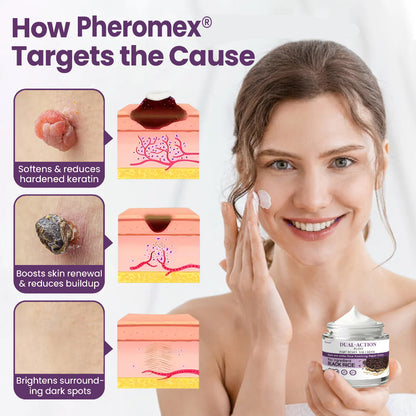 💜✅Pheromex®Dual-Action Plant Wart Removal Cream（👨‍⚕️Skin Tags,Acne,Hyperpigmentation,Eczema,Psoriasis,Rosacea,Warts)