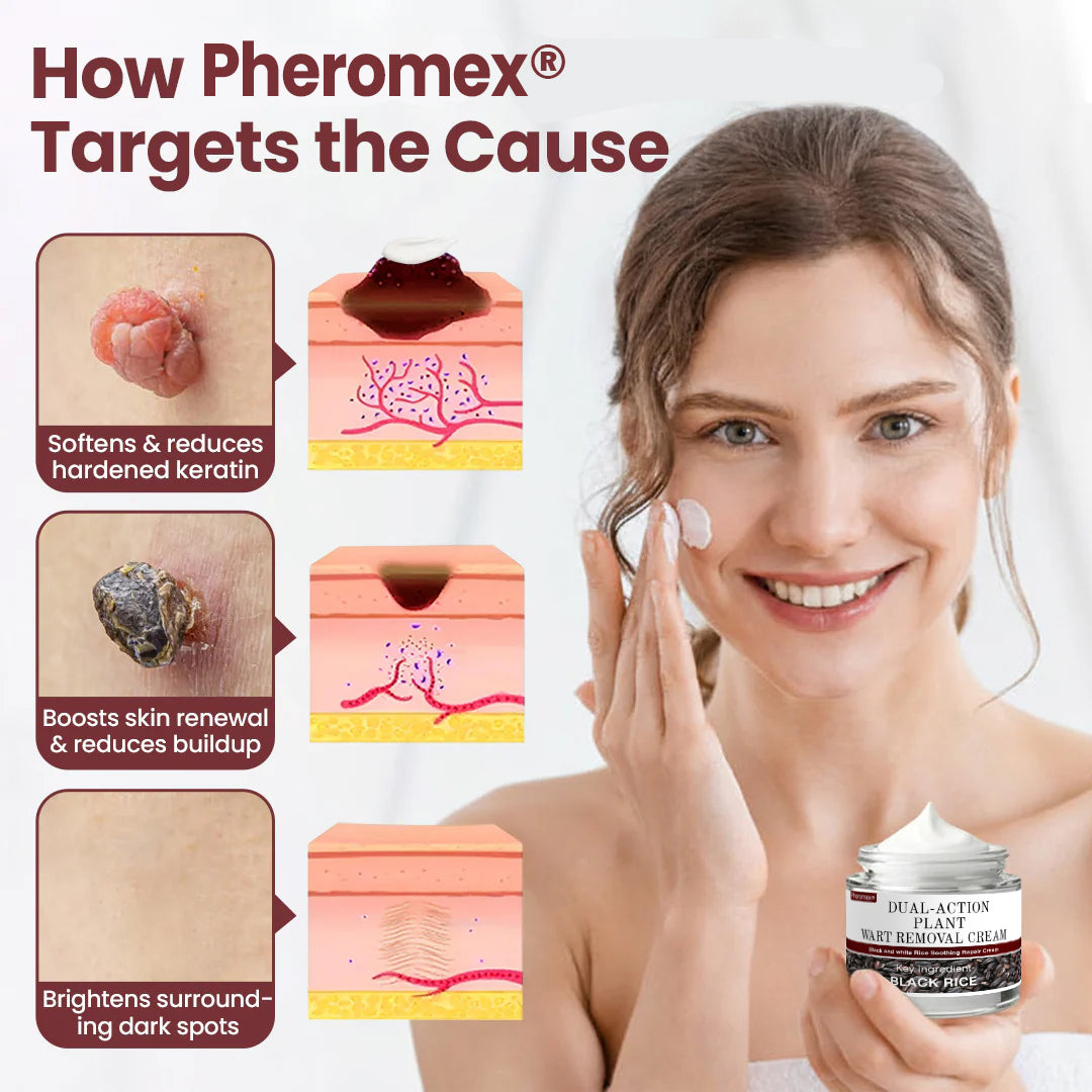 👑✅Pheromex®Dual-Action Plant Wart Removal Cream（👨‍⚕️Skin Tags,Acne,Hyperpigmentation,Eczema,Psoriasis,Rosacea,Warts)