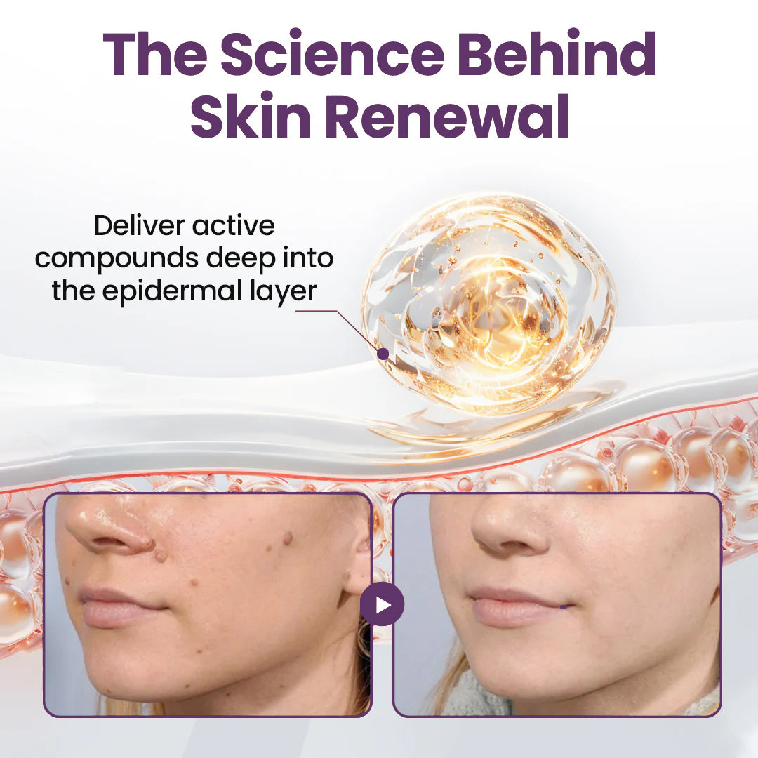 💜✅Pheromex®Dual-Action Plant Wart Removal Cream（👨‍⚕️Skin Tags,Acne,Hyperpigmentation,Eczema,Psoriasis,Rosacea,Warts)