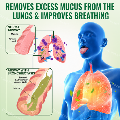 🇬🇧 ✅CareBreeze® Advanced Botanical Mullein Lung Cleanse Melt Strips（👨‍⚕️Directly acts on COPD, asthma, chronic bronchitis (CB), respiratory infections, lung cancer, sinusitis, and other conditions）