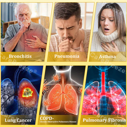 🐝🇬🇧 Official Store:CareBreeze® 6-in-1 Herbal BeePropolis Lung Cleanse Spray（👨‍⚕️Directly acts on COPD, asthma, chronic bronchitis (CB), respiratory infections, lung cancer, sinusitis, and other conditions🫁）