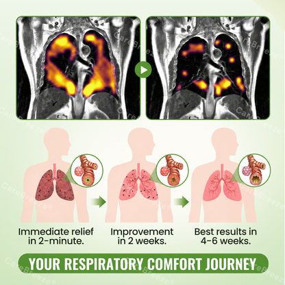 🇬🇧 ✅CareBreeze® Advanced Botanical Mullein Lung Cleanse Melt Strips（👨‍⚕️Directly acts on COPD, asthma, chronic bronchitis (CB), respiratory infections, lung cancer, sinusitis, and other conditions）