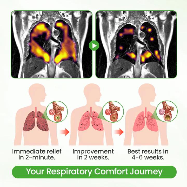 💓✅UK Owned and Operated|CareBreeze® Botanical Mullein Lung Cleanse Diffuser (💝 Cough, wheezing, shortness of breath, sputum, stuffy nose, bronchitis, bronchitis, allergy symptoms, lung discomfort💝)