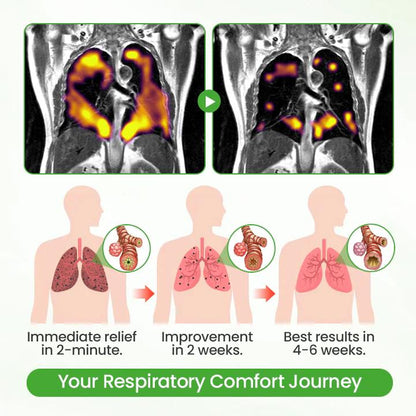 💓✅UK Owned and Operated|CareBreeze® Botanical Mullein Lung Cleanse Diffuser (💝 Cough, wheezing, shortness of breath, sputum, stuffy nose, bronchitis, bronchitis, allergy symptoms, lung discomfort💝)